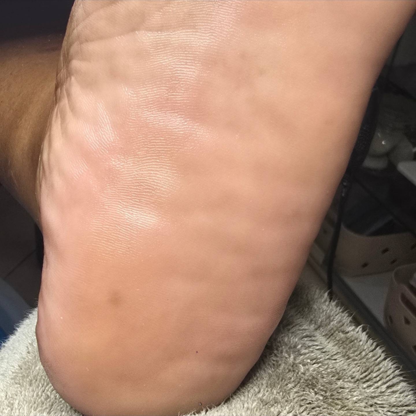 Pedicure Treatments Starting at $50 BBD – Diabetics Welcome